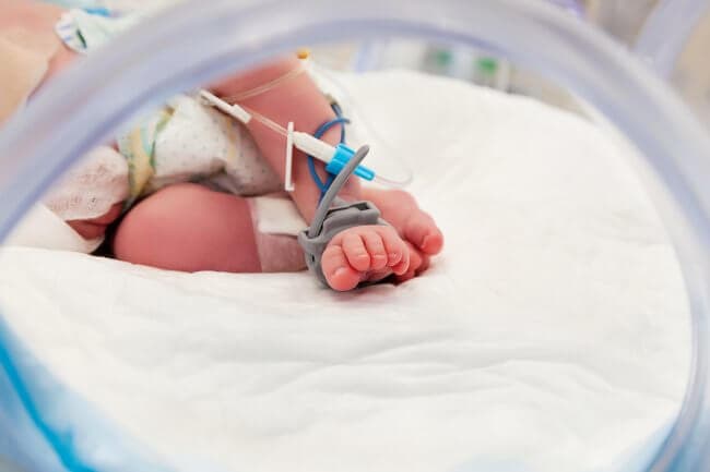 Newborn affected by drug addiction, neonatal abstinence syndrome (NAS), and withdrawal symptoms in infants. Baby Is Born Addicted